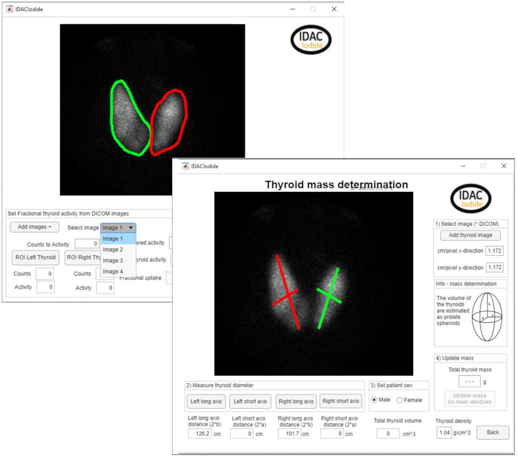 A thyroid iodide uptake and volume determination tool from DICOM images.